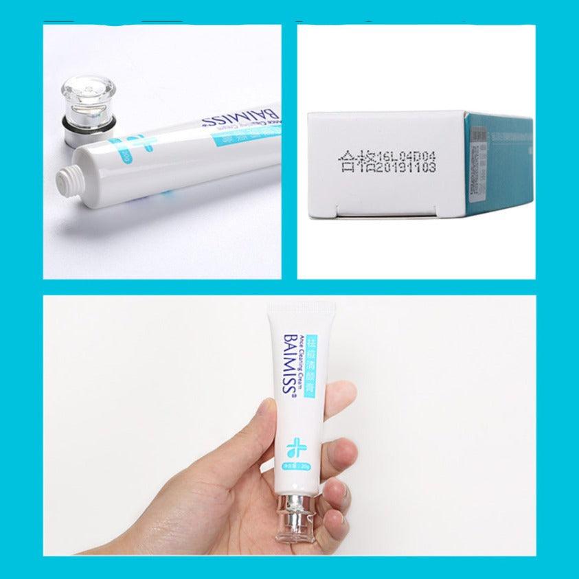 Acne Repair Creame - Mysummerbasics