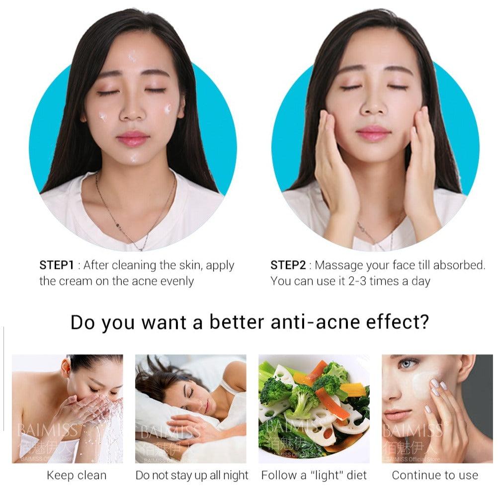 Acne Repair Creame - Mysummerbasics